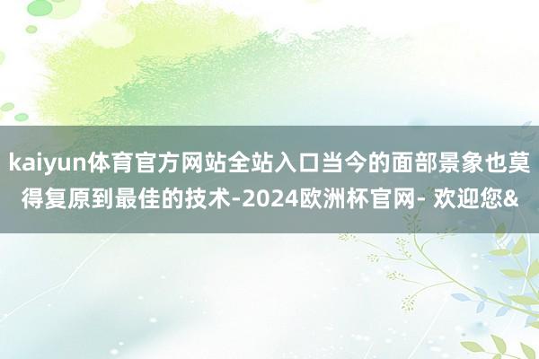 kaiyun体育官方网站全站入口当今的面部景象也莫得复原到最佳的技术-2024欧洲杯官网- 欢迎您&